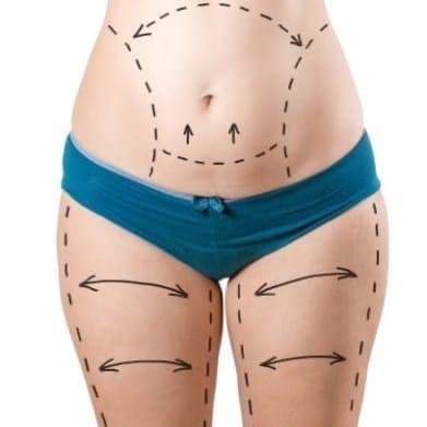 15 hours - Post Op Lymphatic at Angela's Alchemy in Terrell, TX