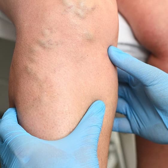 Lymphatic Maintenance Package at Angela's Alchemy in Terrell, TX